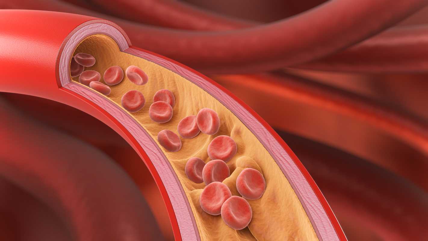 How Statins Work to Lower Cholesterol Levels